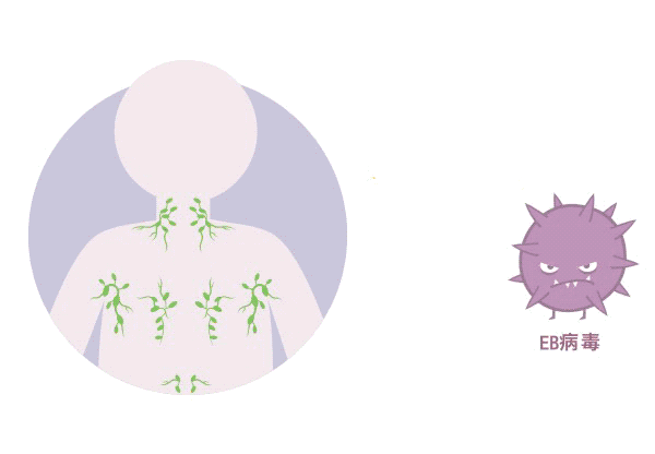 體檢查出“EB病毒”陽性！一定就是鼻咽癌嗎？