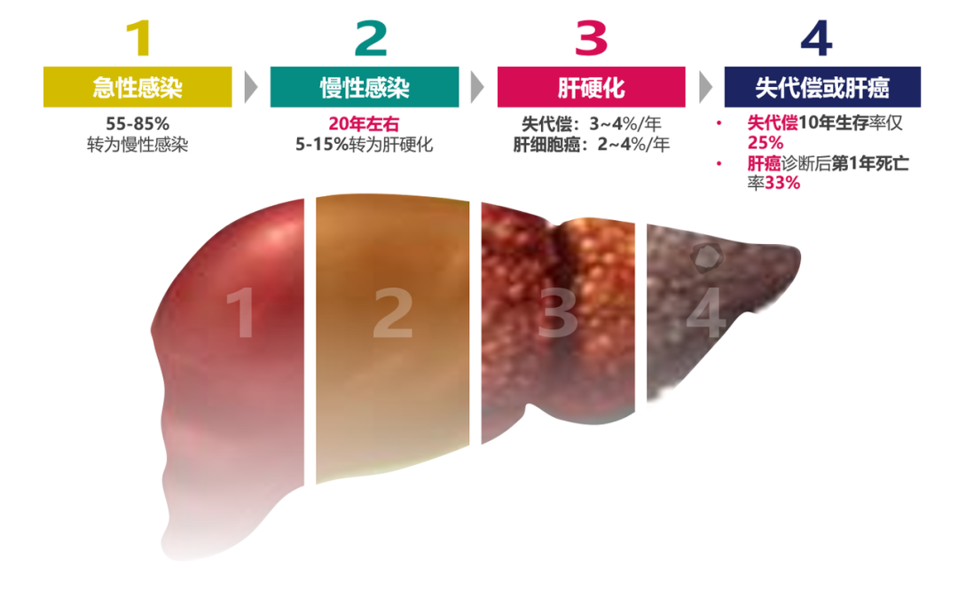 悄悄變成肝硬化、肝癌，很多人感染了卻不知道