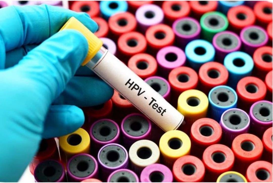 HPV分型檢測的重要性 HPV分型檢測的重要性