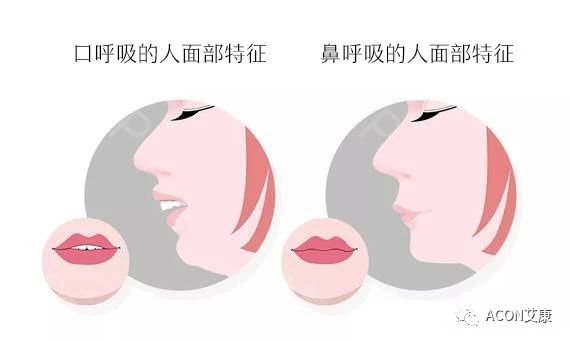 過敏性鼻炎會(huì)讓孩子變傻？！家長該如何應(yīng)對